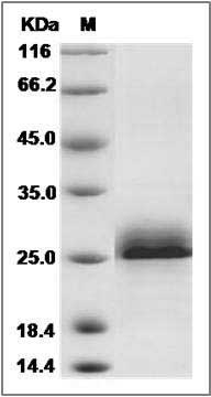 Human Serglycin / SRGN Protein (His & Myc Tag) SDS-PAGE