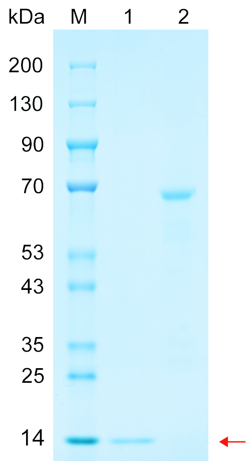 Recombinant BCL6 protein (His tag) SDS-PAGE