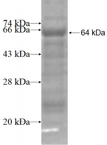 Recombinant Human CETP SDS-PAGE