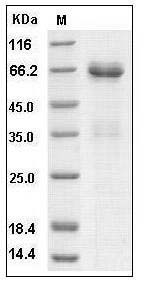Human EpCAM / TROP-1 / TACSTD1 Protein (Fc Tag) SDS-PAGE