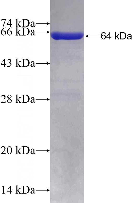 Recombinant Human ATP6V1C2 SDS-PAGE
