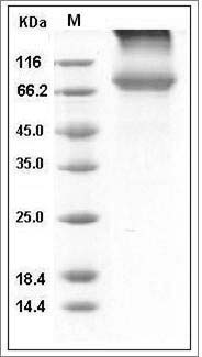 Influenza A H5N1 (A/bar-headed goose/Qinghai/14/2008) Hemagglutinin / HA Protein (His Tag) SDS-PAGE