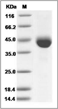 Human COL9A1 Protein (His Tag) SDS-PAGE