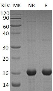 Human AIF1/G1/IBA1 (His tag) recombinant protein