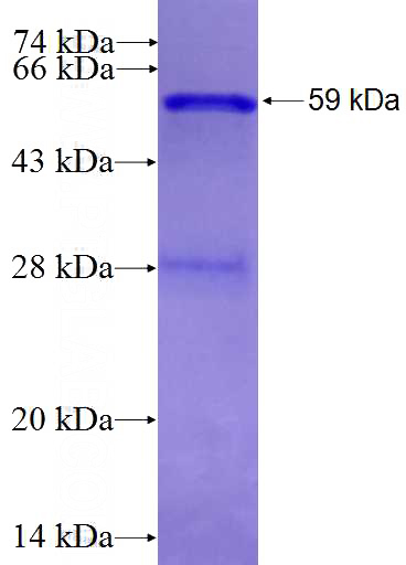 Recombinant Human XPO1 SDS-PAGE