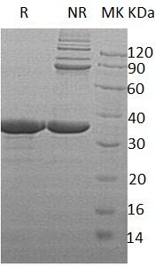 Human SULT2B1/HSST2 (His tag) recombinant protein