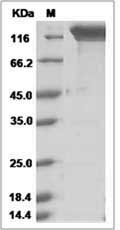 Cynomolgus E-Selectin / CD62e / SELE Protein (Fc Tag)
