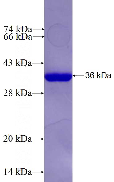 Recombinant Human EXOC3L2 SDS-PAGE