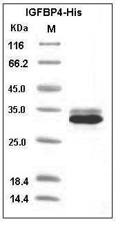 Human IGFBP4 Protein (His Tag) SDS-PAGE
