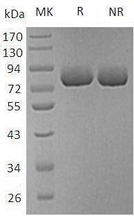 Human SPP1/BNSP/OPN/PSEC0156 (His tag) recombinant protein