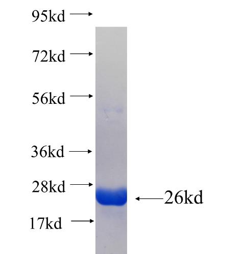Recombinant human RPL11(Full length) SDS-PAGE