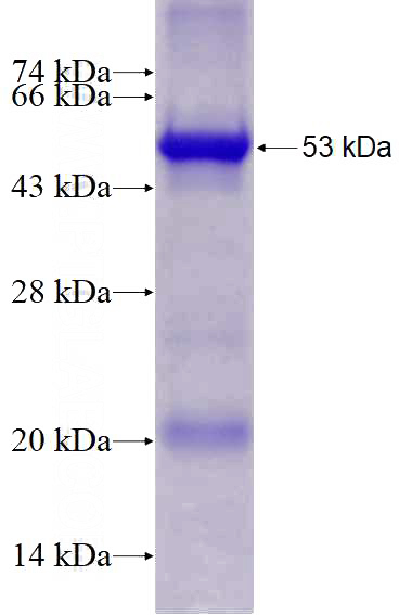 Recombinant Human PICK1 SDS-PAGE