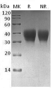 Cynomolgus PDCD1 (His tag) recombinant protein