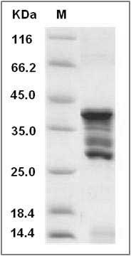 Human CD247 / CD3-ZETA Protein (GST Tag) SDS-PAGE