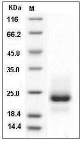Human TRAIL R1 / CD261 / TNFRSF10A Protein (His Tag) SDS-PAGE