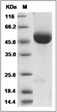 Rat CD5 Protein (His Tag) SDS-PAGE