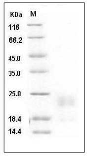 Mouse HAI-2 / SPINT2 Protein (His Tag) SDS-PAGE