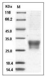 Ferret CD8A / CD8 alpha chain Protein (His Tag) SDS-PAGE