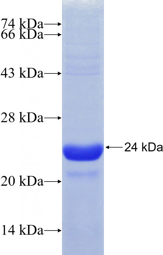 Recombinant Human HN1L SDS-PAGE