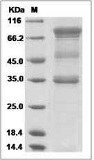 UNC5A protein SDS-PAGE