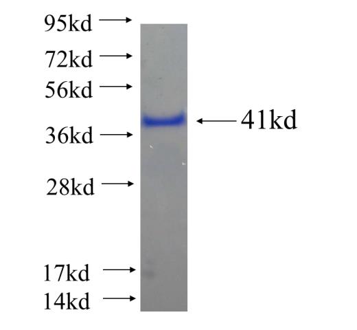 Recombinant human C15orf29 SDS-PAGE
