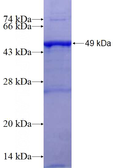 Recombinant Human C17orf81 SDS-PAGE