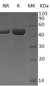 Human CPA4/CPA3/UNQ694/PRO1339 (His tag) recombinant protein