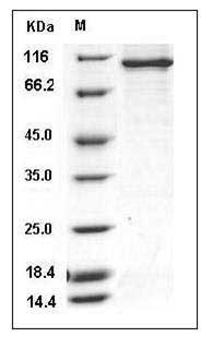 Human STK23 / MSSK1 / SRPK3 Protein (His & GST Tag) SDS-PAGE