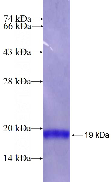 Recombinant Human IER5 SDS-PAGE