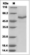 Mouse Testican-3 / SPOCK3 Protein (His Tag) SDS-PAGE