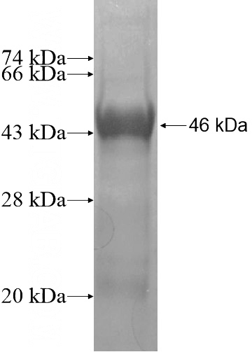 Recombinant Human RSBN1L SDS-PAGE