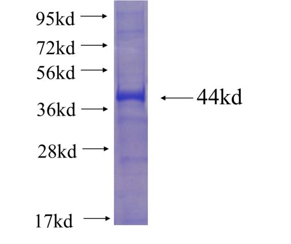Recombinant human ENTPD4 SDS-PAGE