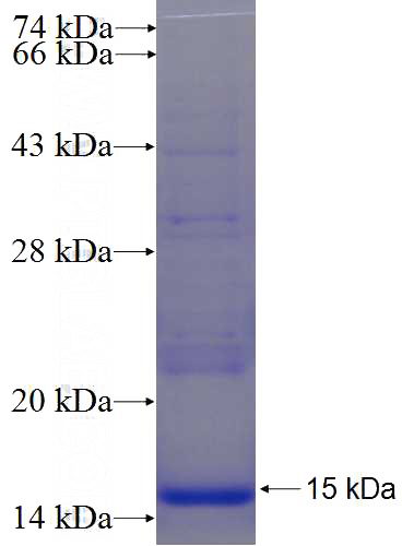 Recombinant Human SIRPD SDS-PAGE