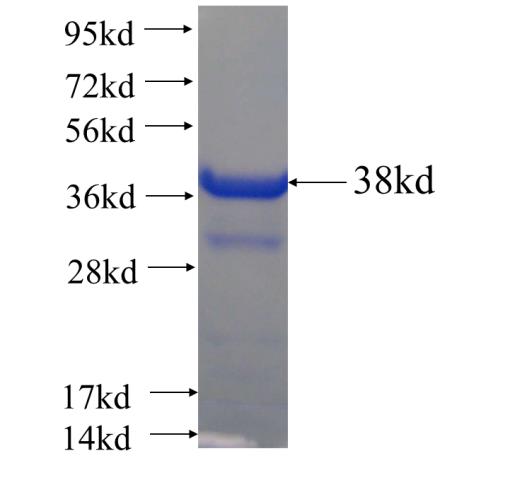Recombinant human S100A4 SDS-PAGE