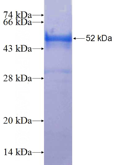 Recombinant Human WDR35 SDS-PAGE