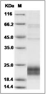 Human NKG2D / CD314 Protein (aa 78-216, His Tag) SDS-PAGE