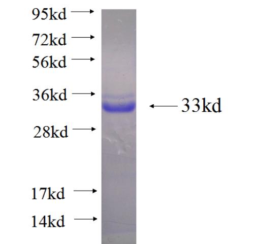 Recombinant human TTLL10 SDS-PAGE