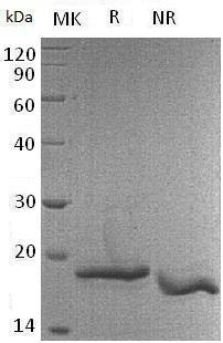 Mouse Col18a1 (His tag) recombinant protein