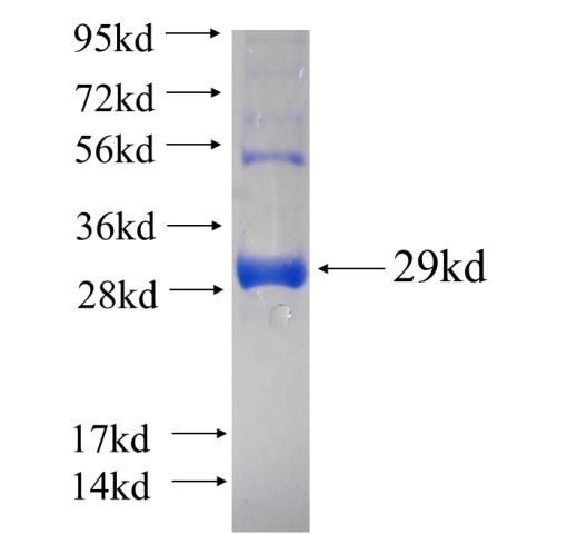 Recombinant human GPR177 SDS-PAGE