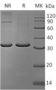 Human MOB4/MOB3/MOBKL3/PHOCN (His tag) recombinant protein