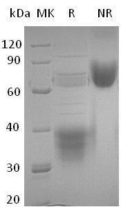 Human CLU/APOJ/CLI/KUB1/AAG4 (His tag) recombinant protein