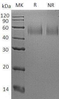 Human LRRC3B/LRP15/UNQ195/PRO221 (His tag) recombinant protein