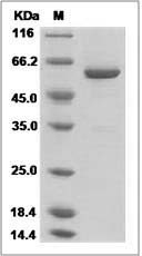 PTPN9 protein SDS-PAGE