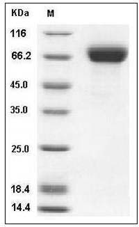Influenza A H5N1 (A/duck/Hunan/795/2002) Hemagglutinin / HA Protein (His Tag) SDS-PAGE