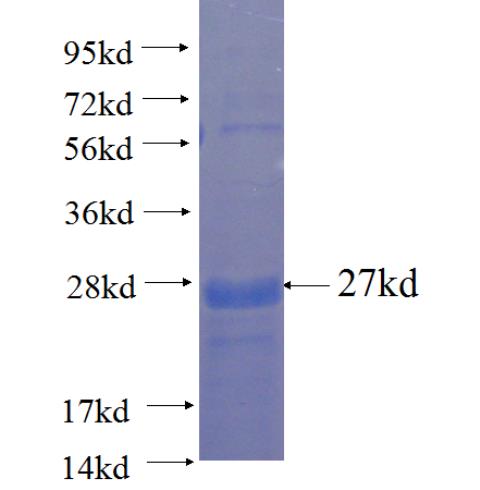 Recombinant human FAM110B SDS-PAGE