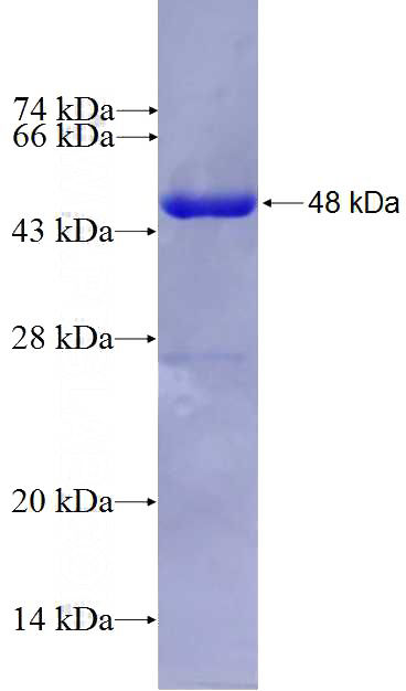 Recombinant Human GDPD1 SDS-PAGE