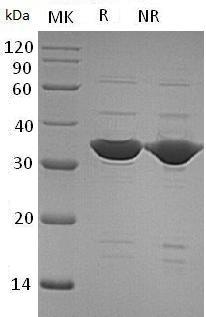 Human ANXA5/ANX5/ENX2/PP4 recombinant protein