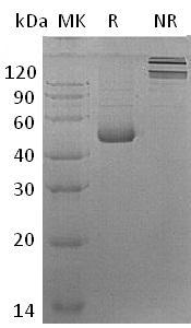 Human CFC1 (His tag) recombinant protein