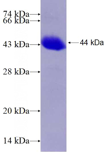 Human XRCC5 Recombinant protein (6*His tag)