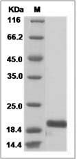 Mouse bFGF / FGF2 Protein (His Tag) SDS-PAGE